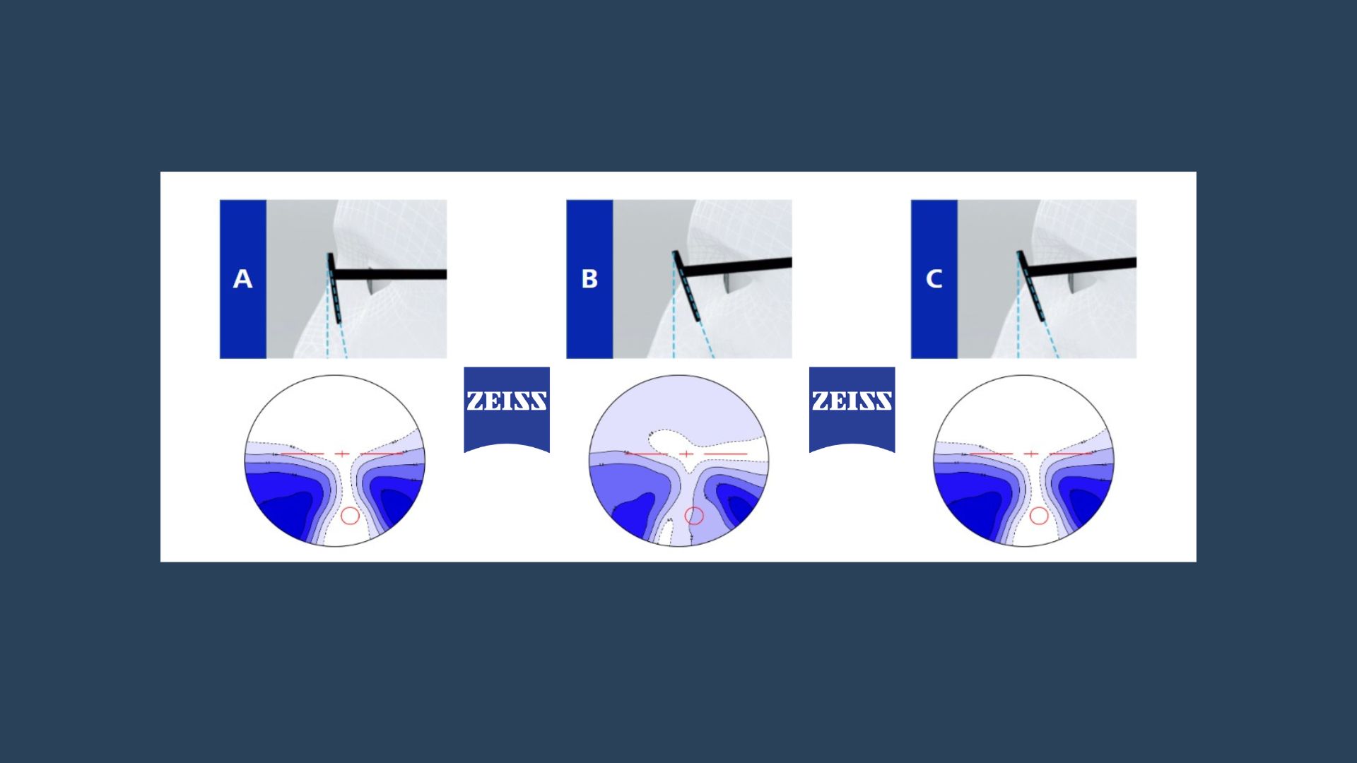 FaceFit™ Tehnologija