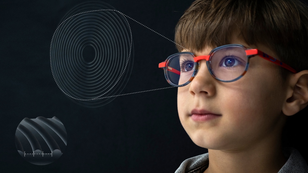 Zeiss MyoCare